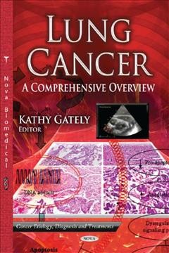 Lung cancer [electronic resource] : a comprehensive overview / Kathy Gately, editor.